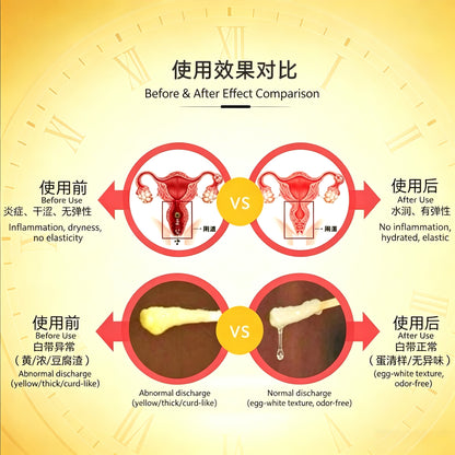 Feminine Antibacterial & Anti-Inflammatory Gel(Specification: 3g per tube, 30 tubes per box)